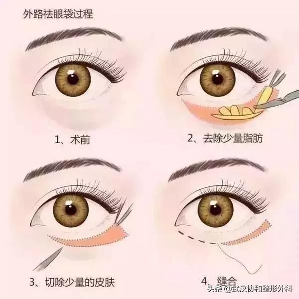 上海九院整形和协和整形,北京协和整形医院美容整形价格