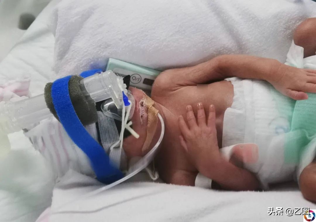 早产儿为什么一出生病危,早产儿1斤5活下来了
