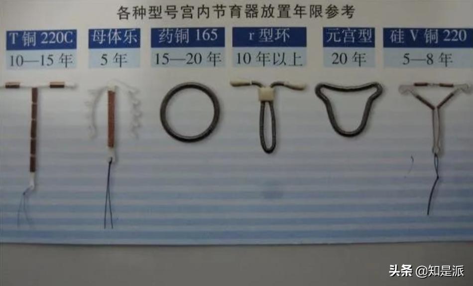 男婴手握节育环出生后续,手握避孕环的胎儿