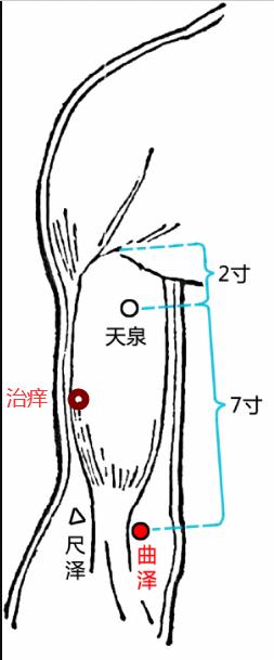 阴痒怎么针灸,妇科紧致针灸