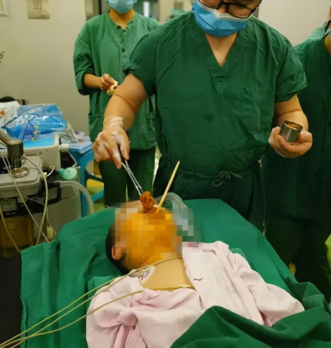 女童误吞降压药身亡,女童服降压药身亡