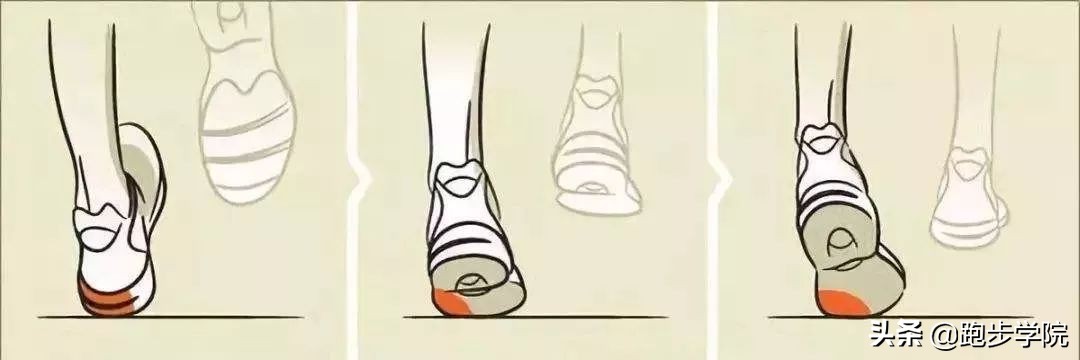 足底筋膜炎改善和解决的方法,足底筋膜炎的预防治疗和恢复