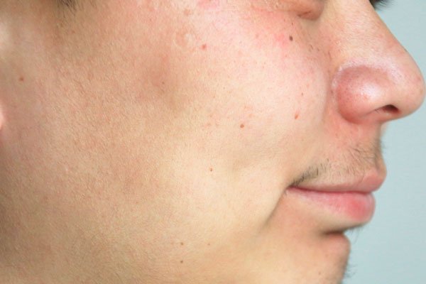 老年斑什么造成的,老年斑的原因是什么引起的