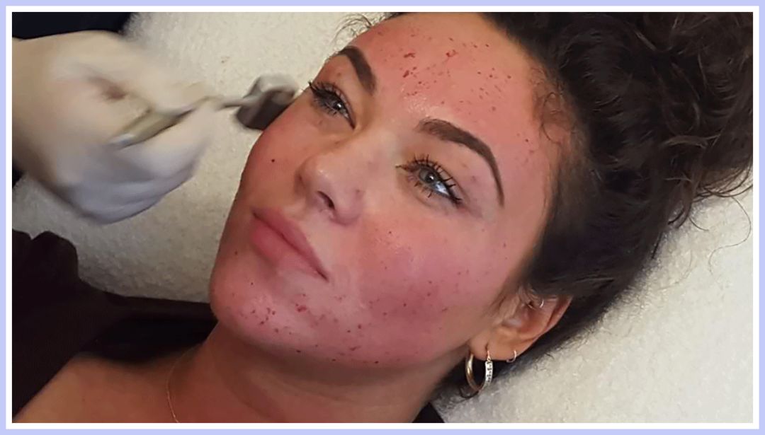 如果被祛痘机构坑了怎么办,我被私立医院骗了怎么办