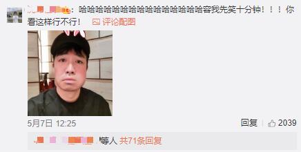 俞灏明牙龈上火脸肿,俞灏明牙龈肿胀图片