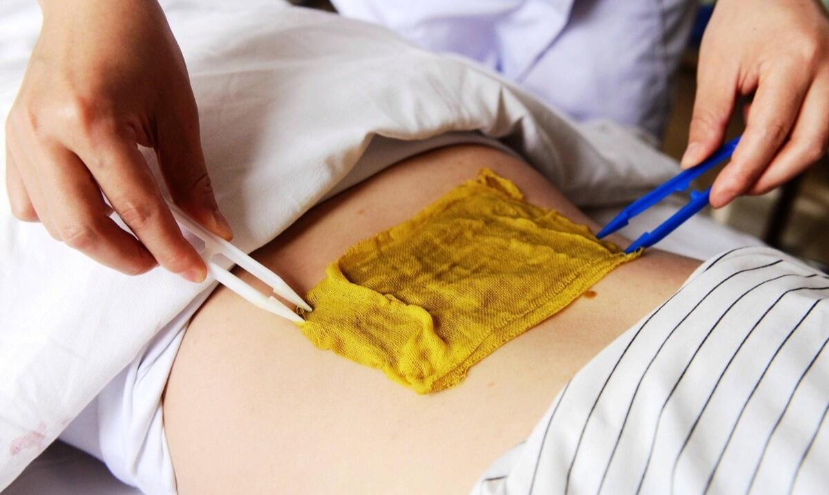 带状疱疹患者如何治疗？祖国医学对其发病机制有较多见解，需了解