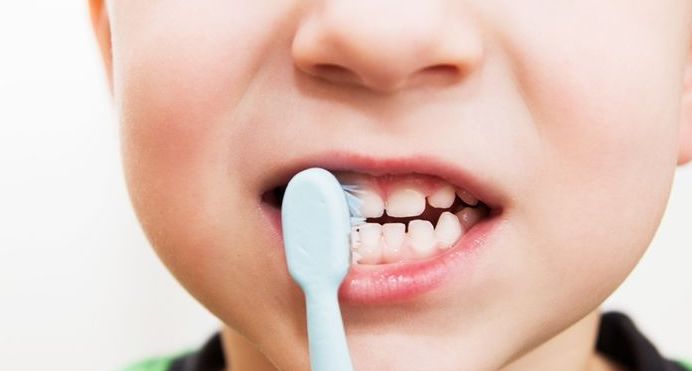 儿童牙齿如何保护防止蛀牙,预防小孩牙齿蛀牙最好做保护方法