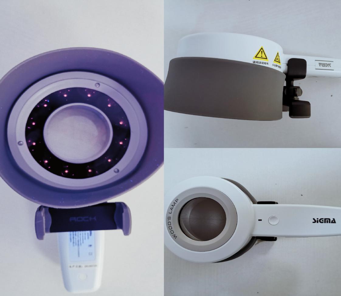 皮肤病医院的红光治疗仪,皮肤病伍德氏灯