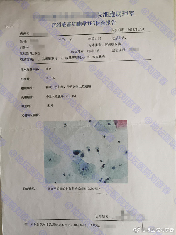 女，35岁，CIN2级，姑娘们，还以为宫颈癌离你们很远吗？