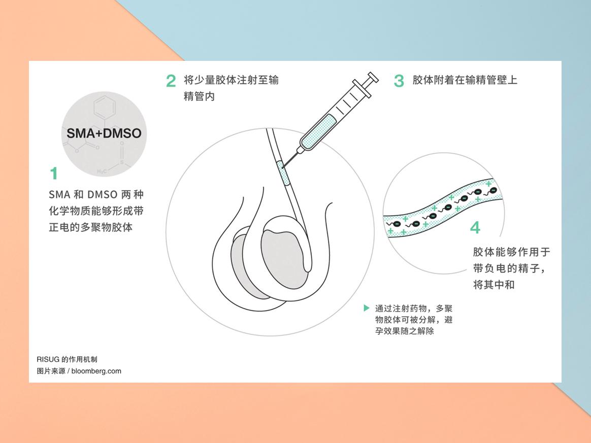 首款注射式男性避孕药通过临床试验，男性避孕时代近在眼前了？