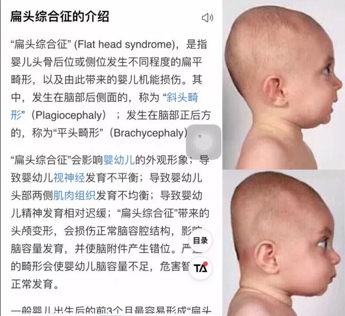 颅顶高扁头怎么睡成圆头,如何拯救高颅顶大扁头