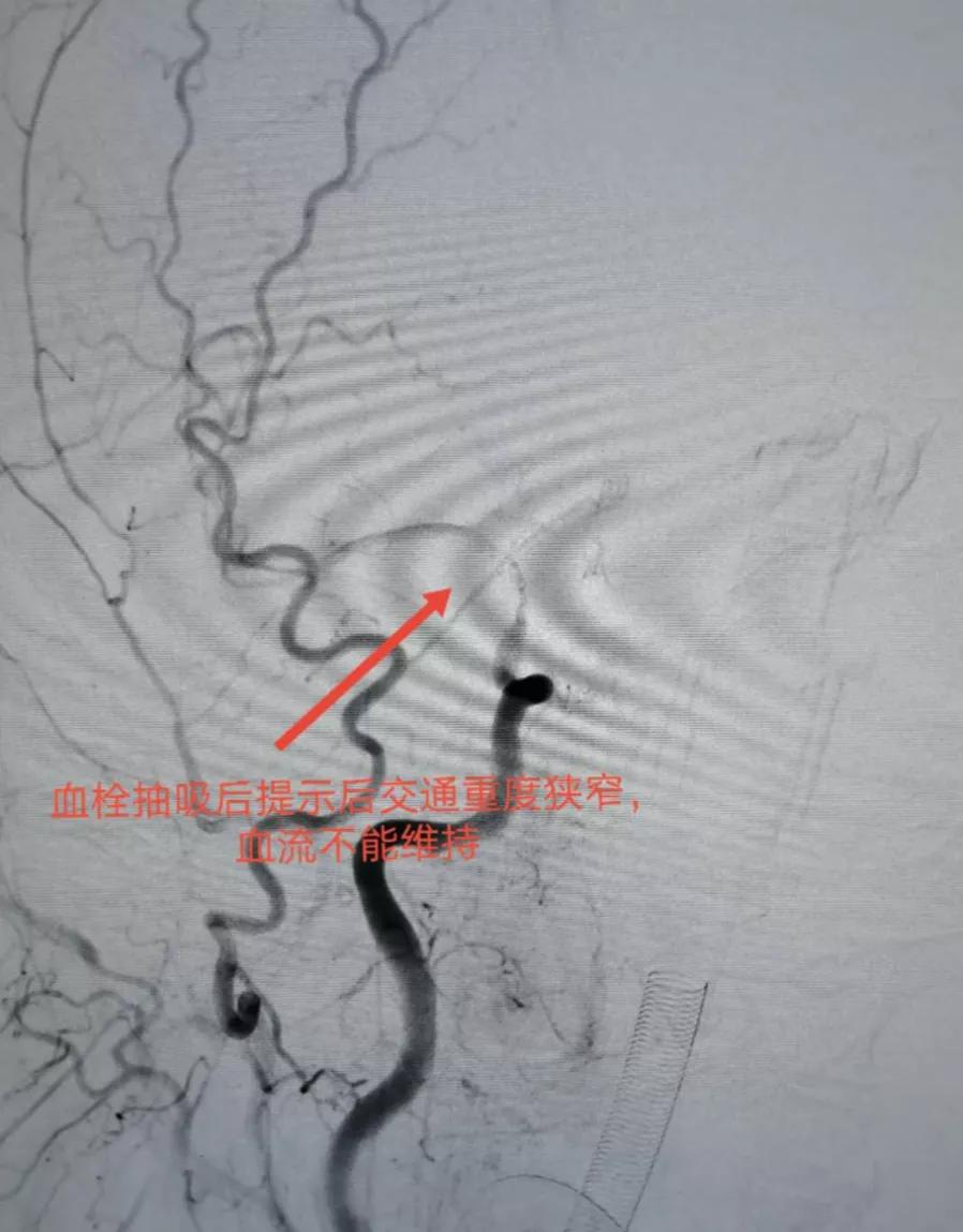 咸阳市最好的神经内科,咸阳市第一人民医院神经内科专家