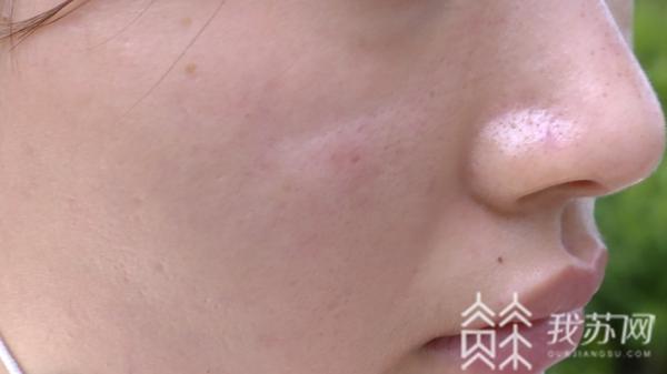 童颜针价格一般多少钱,童颜针揭秘