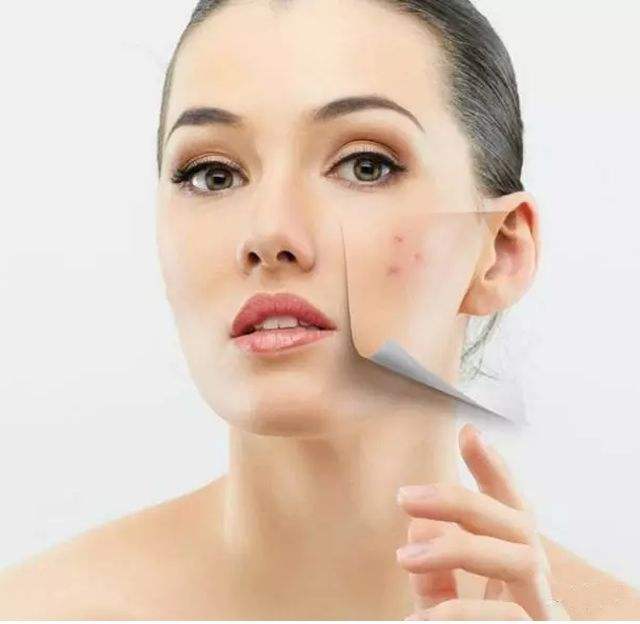 根除眼袋黑眼圈皱纹皮肤暗黄,中年人黑眼圈眼袋能根除吗