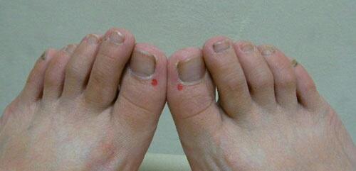 这5个症状需警惕,这十个症状说明你健康