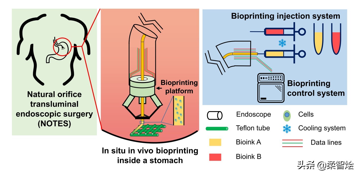 新型机器人可实现人体内3d打印,人工智能机器人治疗肿瘤