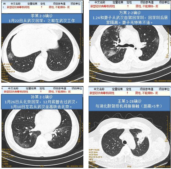 深圳第二人民医院疫情防控,深圳市第二人民医院抗疫情