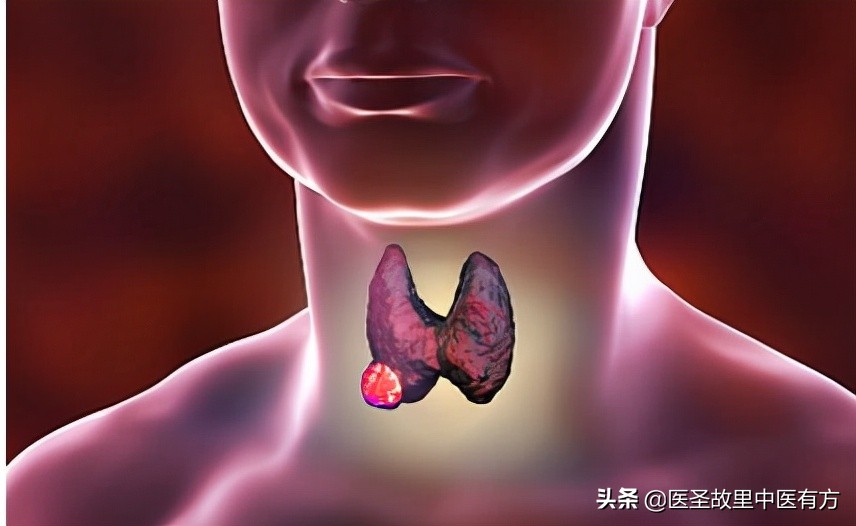 消囊汤组方,民间中药名方消囊汤