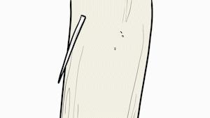 爱因斯坦的发型竟然是罕见病,爱因斯坦头发为什么总是乱糟糟的