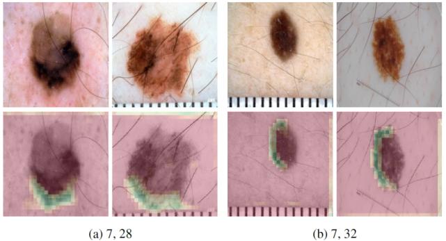 浅谈医学影像学习与实践,基于深度学习的医学影像研究思路
