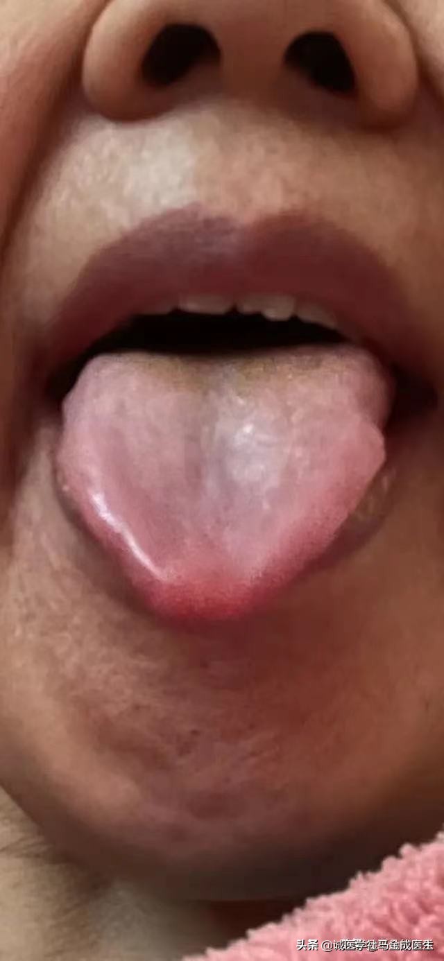 月经量少吃什么中成药能调理,月经量少有黑块用什么中成药