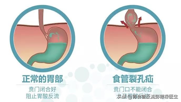 81岁老爷子,老人临终前说肚子里烧得慌