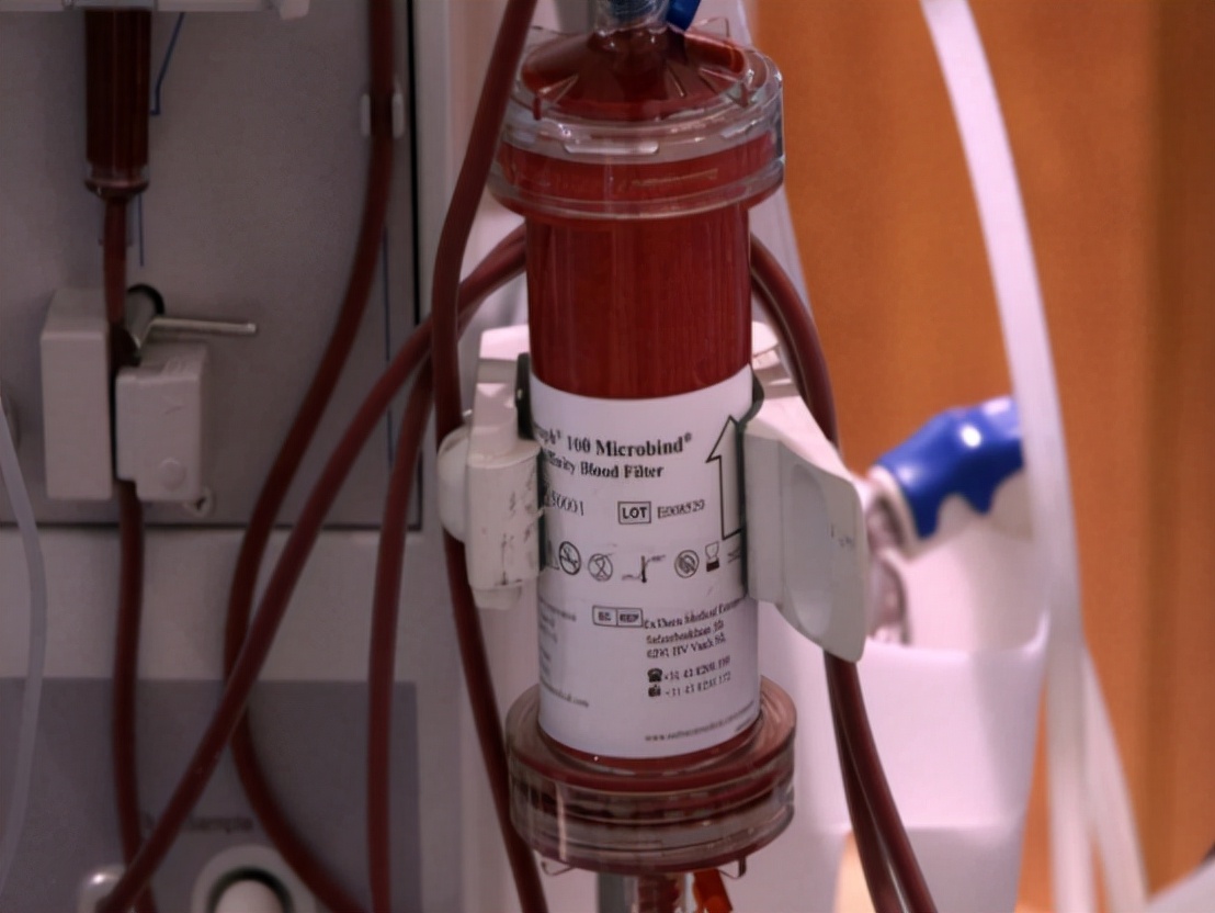 亲人不幸进了ICU，都会经历哪些痛苦？先给你介绍4个