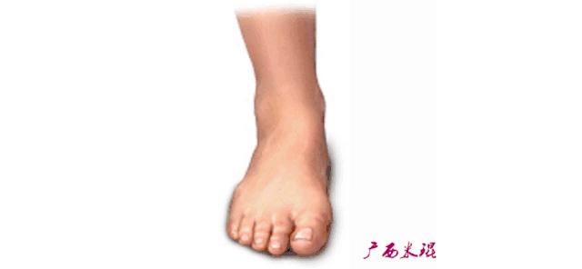 为什么踝关节扭伤容易崴脚,崴到脚踝关节扭伤怎么处理好得快