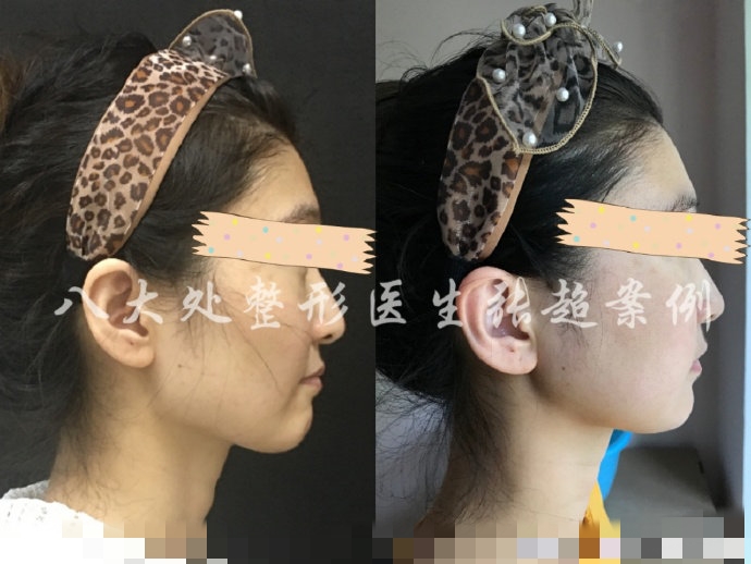 八大处张超抖音,八大处张超合集