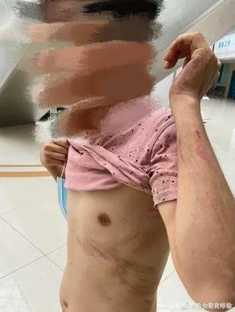 张含韵穿短裙现身,张含韵穿黑裙子