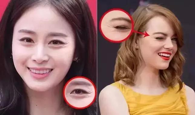 雅诗兰黛日本产的眼霜,用了雅诗兰黛皱纹更明显了