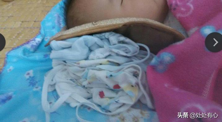 偏头疼的危害有哪些,长时间偏头有什么危害