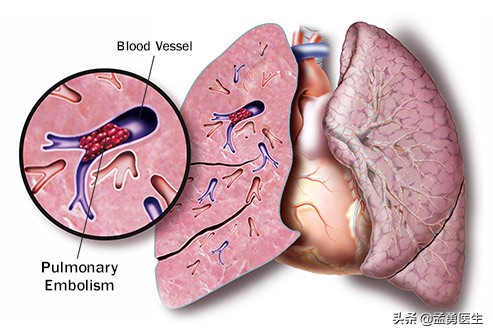 有时会出现不明原因的胸痛,可能引起胸痛的所有疾病