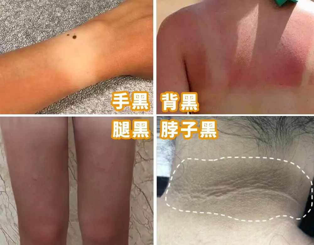 黑皮克星上线！澳洲销量第一羊奶皂，马云点赞，李佳琦直播打call