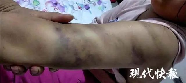 小学因作业被打,学生作业未完成被老师打了巴掌