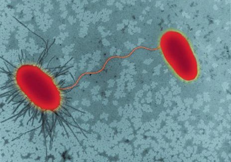 最近3天灰白色分泌物增多,有腥臭味,这是得了什么病?