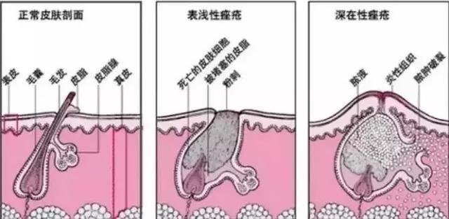 超临界蜂胶与普通蜂胶有几大优点,纯天然蜂胶的作用与功效