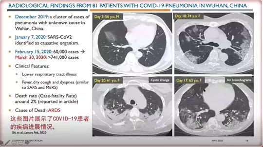 癌症中心SimritParmar教授:脐带血的最新应用