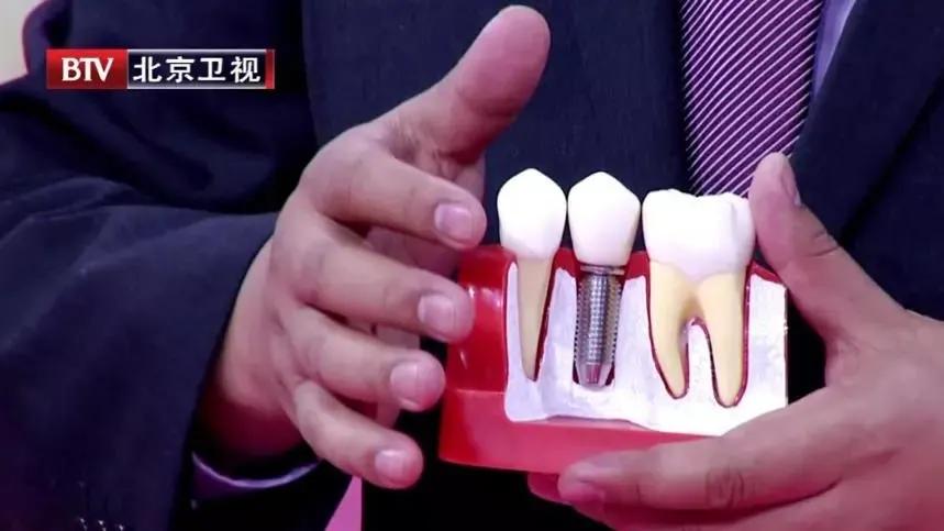 吃饭老塞牙缝怎么治疗,吃饭总塞牙你知道问题出在哪里吗