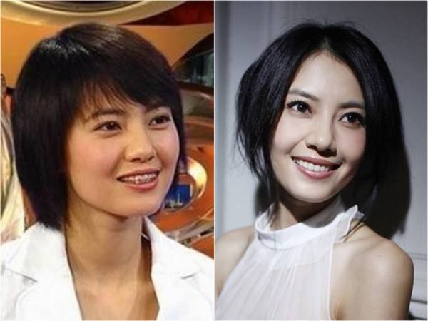 蔡徐坤整牙前后对比图片,蔡徐坤整牙前图片