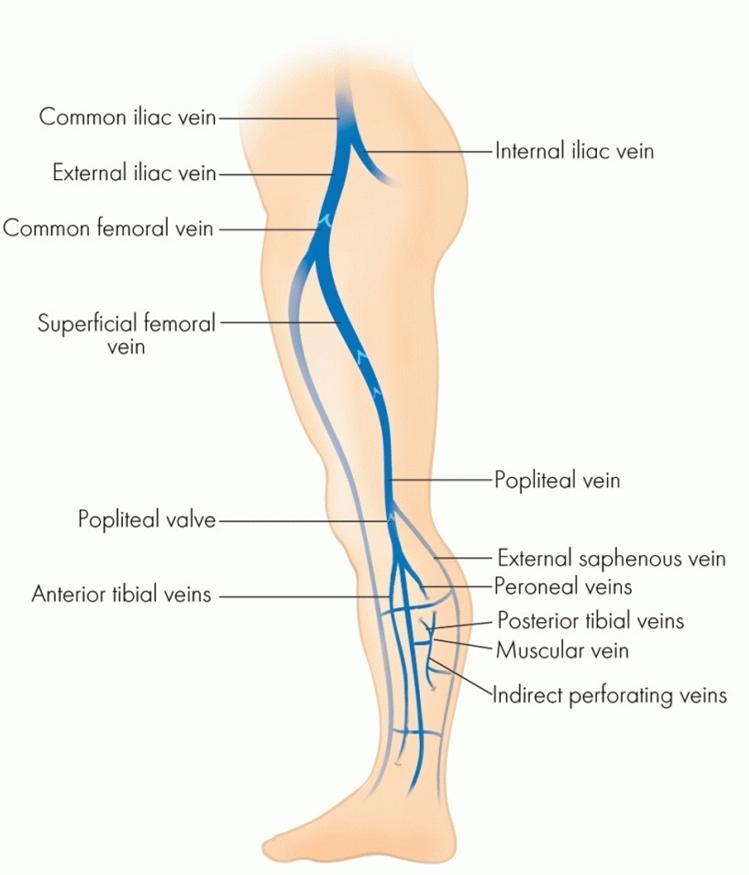 工作引起静脉曲张怎么办,下肢静脉曲张属于职业病吗