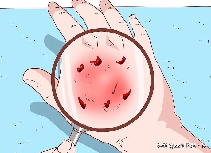 怎么处理狗咬伤口,狗咬伤口怎么处理