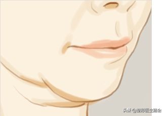 有几种下巴,有三个下巴是为什么