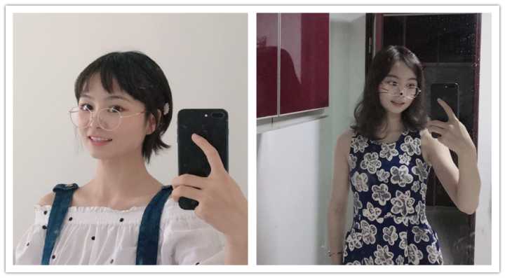 咬肌型发腮怎么改善,大脸方脸女生如何快速改变脸型