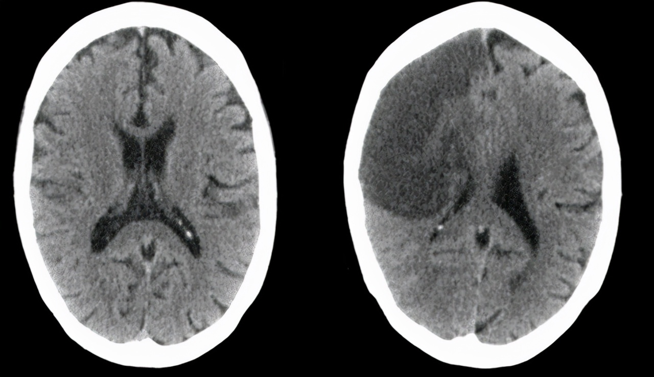 身体二处发痒要警惕,身体二处发痒表明肝出现问题