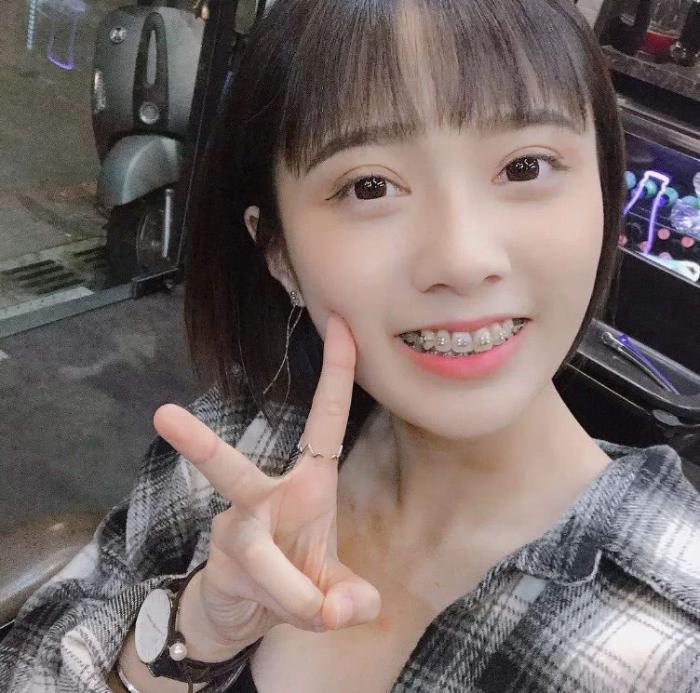 带牙套究竟是什么样的体验？过来人道出大实话，网友：心疼