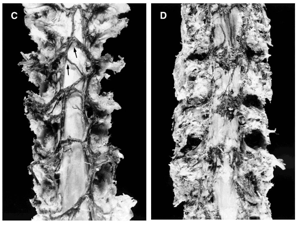 文献查阅|文献综述——椎静脉丛