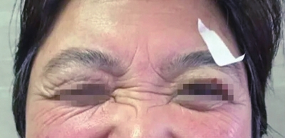 左眼跳财右眼跳灾眼皮总跳啥原因,左眼皮跳财右眼皮跳灾的真实含义