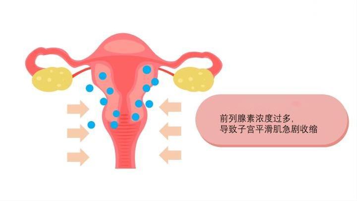 别让痛经假好心成坏事,别让痛经成为女性的噩梦