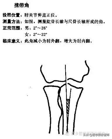 肘关节x线测量,肘关节骨骺示意图